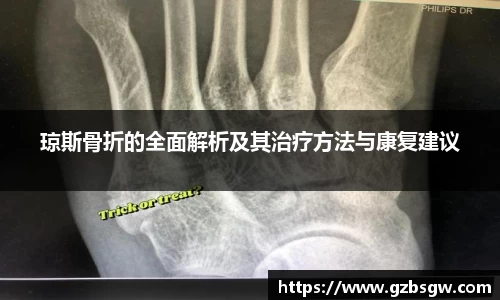 琼斯骨折的全面解析及其治疗方法与康复建议